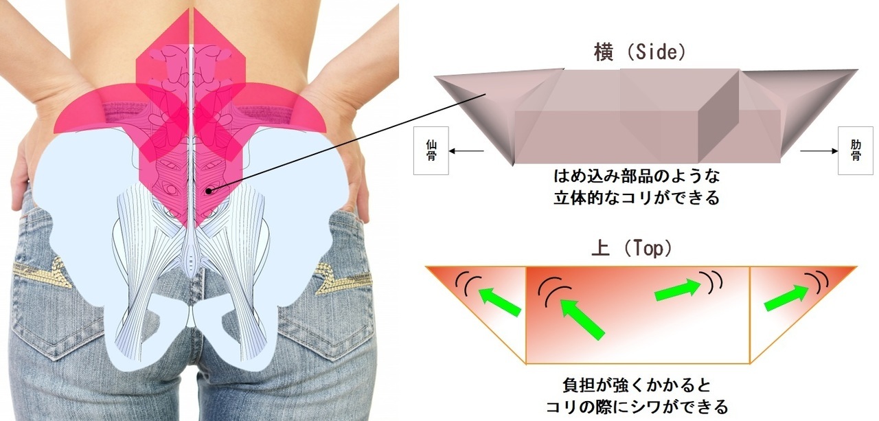腰椎から仙骨のコリ