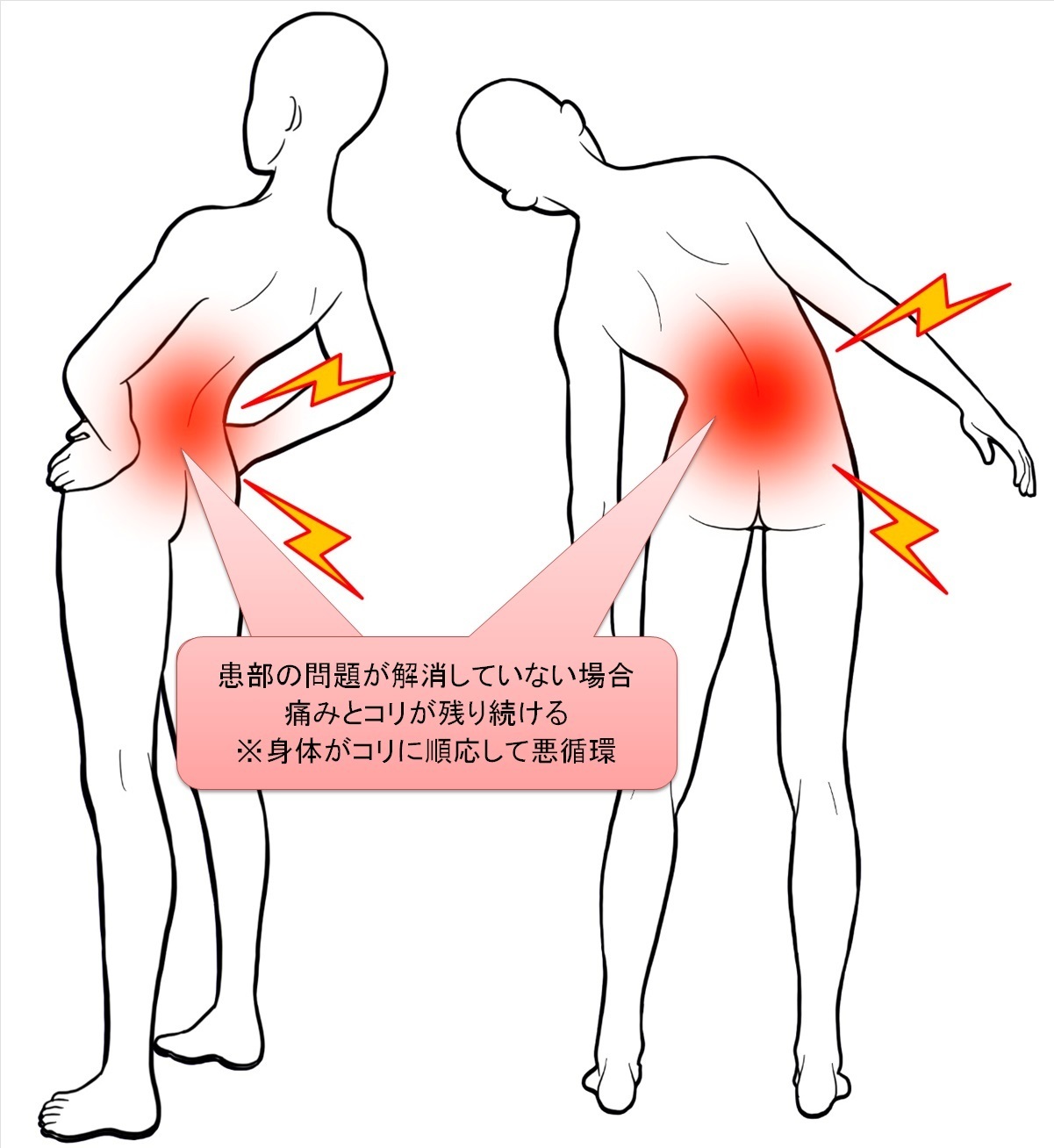 痛みや炎症に対する整体3