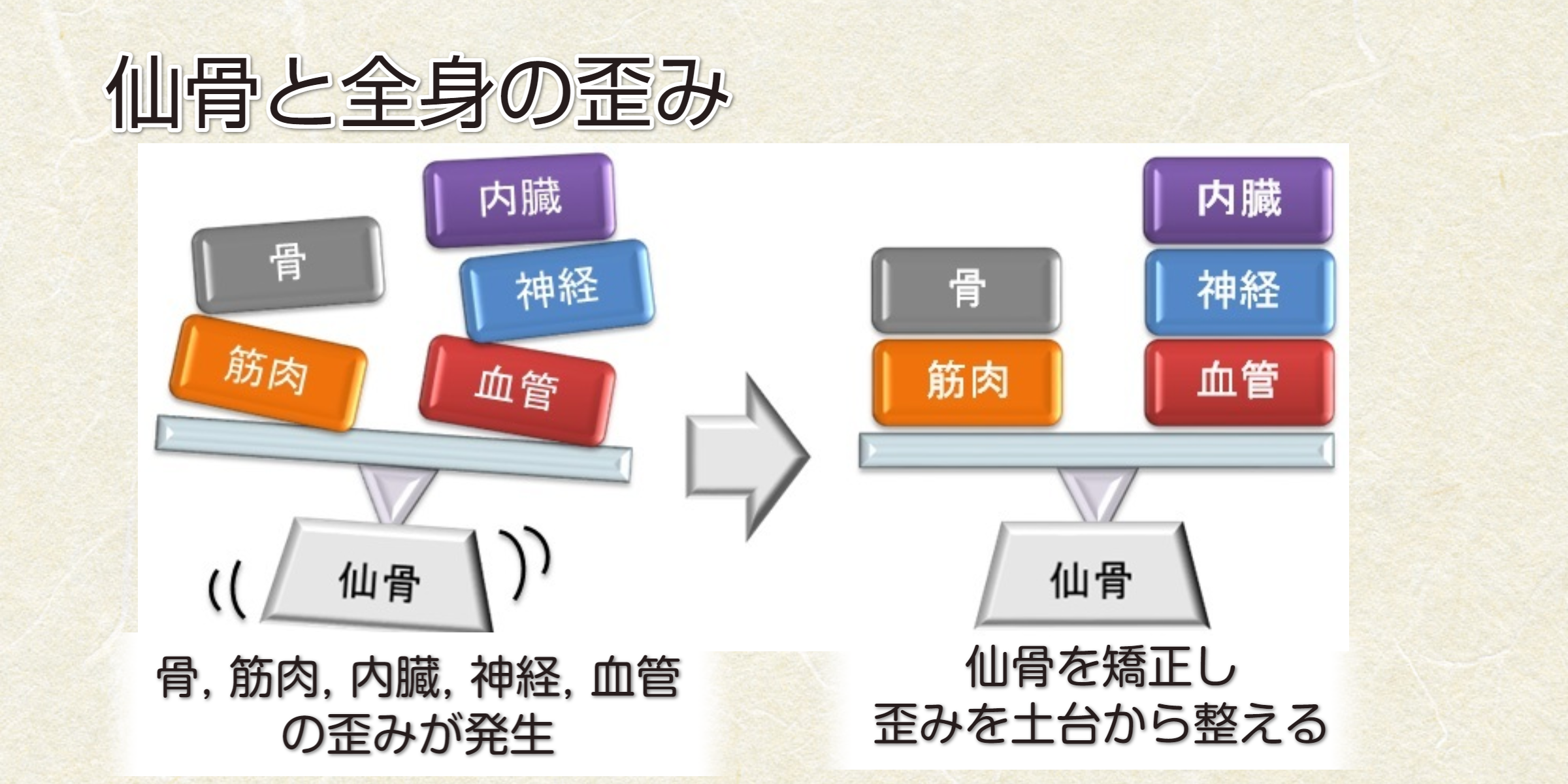 仙骨と歪み