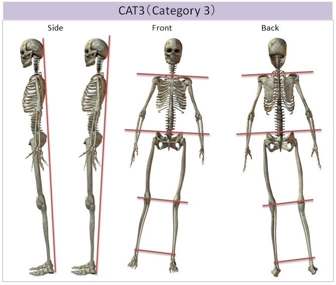 Category 3 Balance