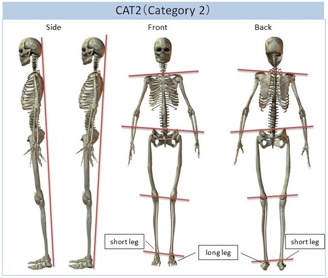 Category 2 Balance