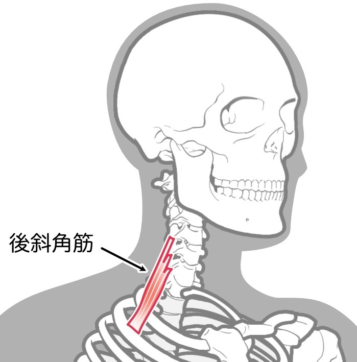 後斜角筋ライン