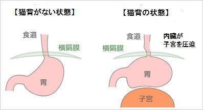 猫背と子宮・卵巣