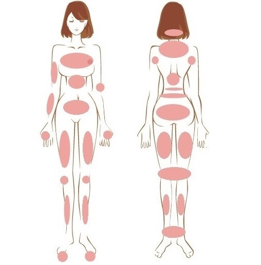 やま_重点施術