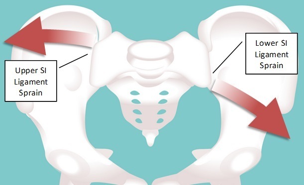 Sacrum_sepa