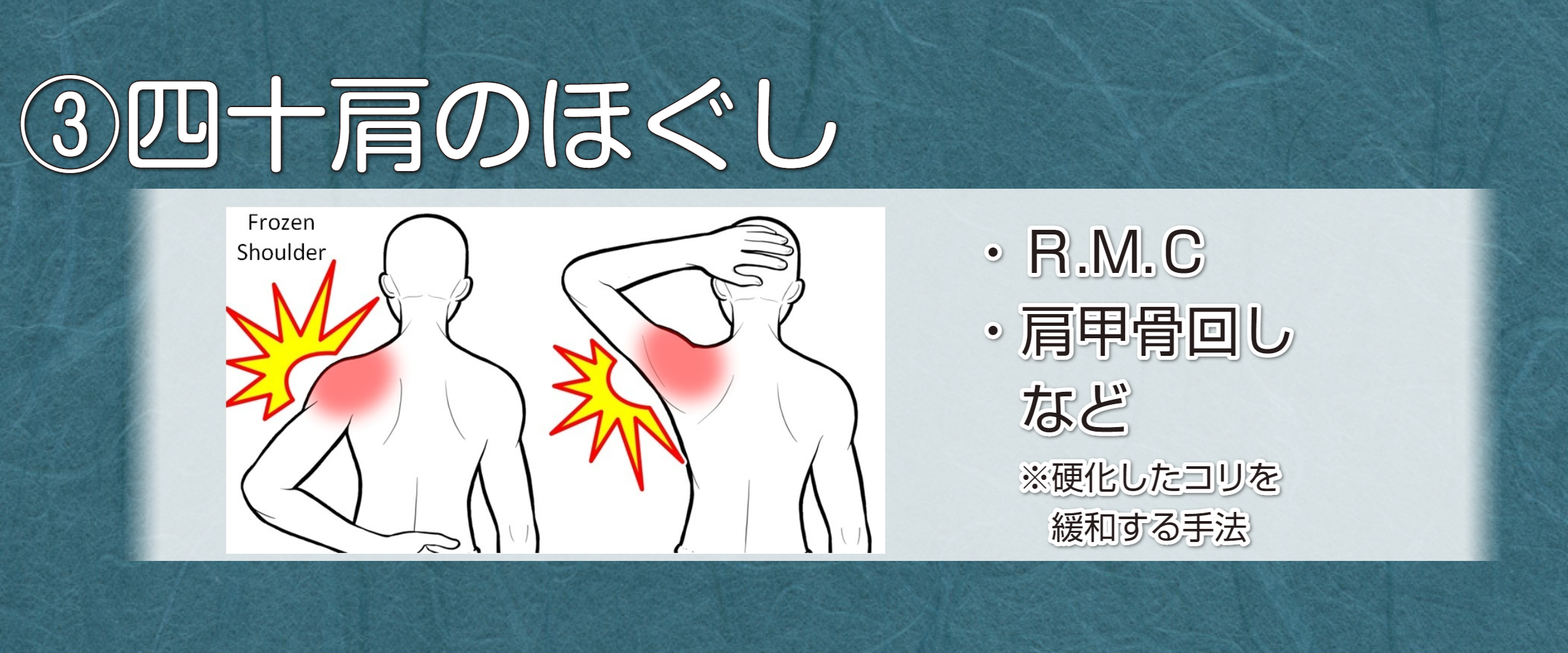 首いかり肩６